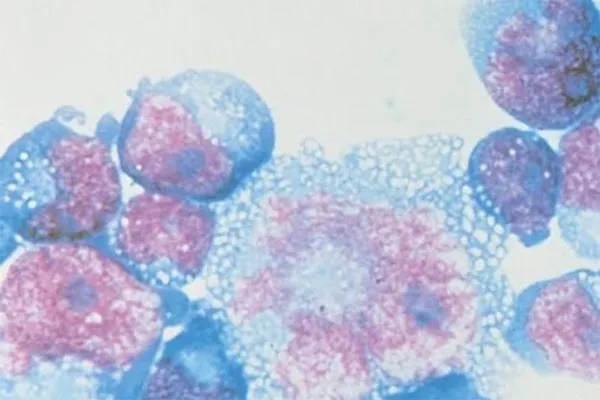 Bacterie