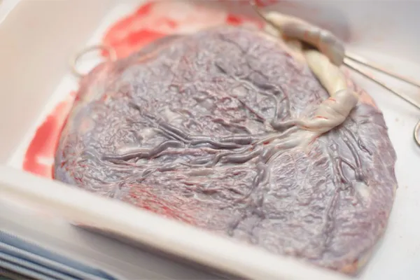 Placenta